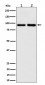 Anti-CSDE1 Rabbit Monoclonal Antibody